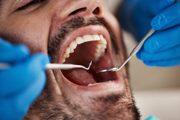 Best Walk-In Emergency Dental Services in Creedmoor, NC