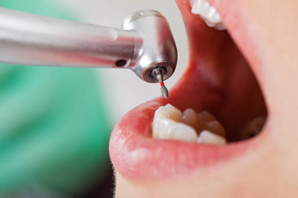 Best Lost Filling or Crown Replacement in Creedmoor, NC